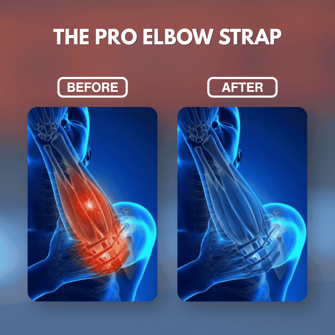 The Pro Elbow Strap